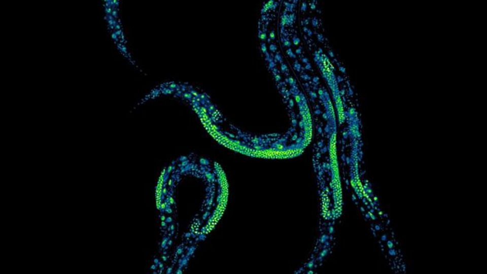Image of five Caenorhabditis elegans taken at the Centre for Genomic Regulation’s research labs.