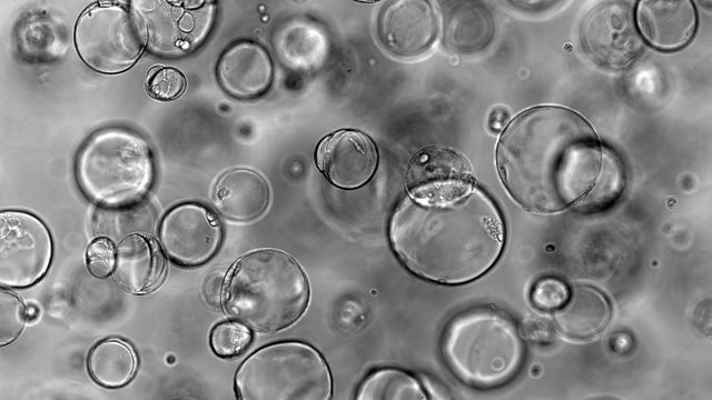 Phase-contrast micrograph of stem cell culture with spherical cells and a 100 µm scale. 