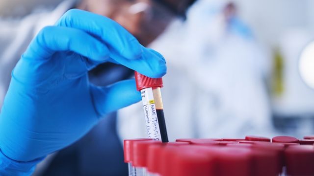 Laboratory technician handling labeled blood samples for single cell sequencing analysis. 
