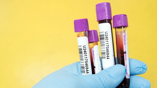 Gloved hand holding blood sample vials for a blood test for colon cancer. 