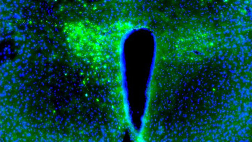 A fluorescence microscopy image of a mouse hypothalamus, with neurons shown in green.