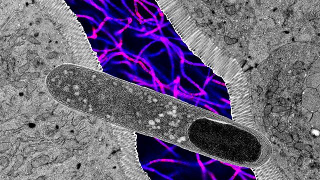 Microscope images showing a rod-shaped Turicibacter, intestine cross section and fluorescent microscopy of more bacteria.  
