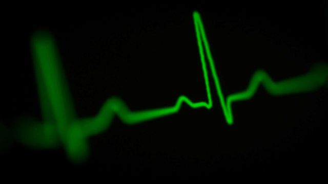 Green ECG waveform illustrating an AI tool using ECGs to detect liver disease. 