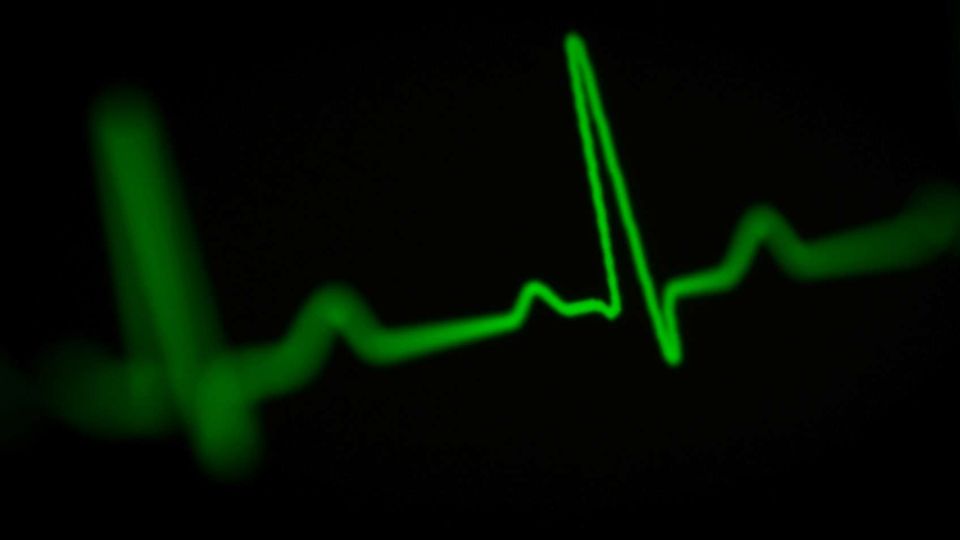 Green ECG waveform illustrating an AI tool using ECGs to detect liver disease.