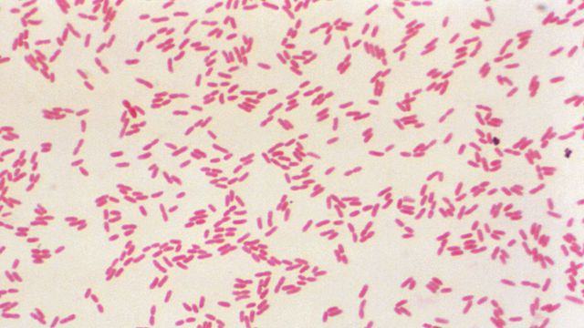 Gram-negative, rod-shaped, Burkholderia pseudomallei bacteria. under a microscope, relevant to vaccine research and development. 