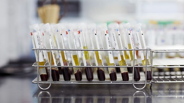 A rack of test tubes containing separated blood plasma and cells, suitable for use in droplet digital PCR (ddPCR) analysis. 