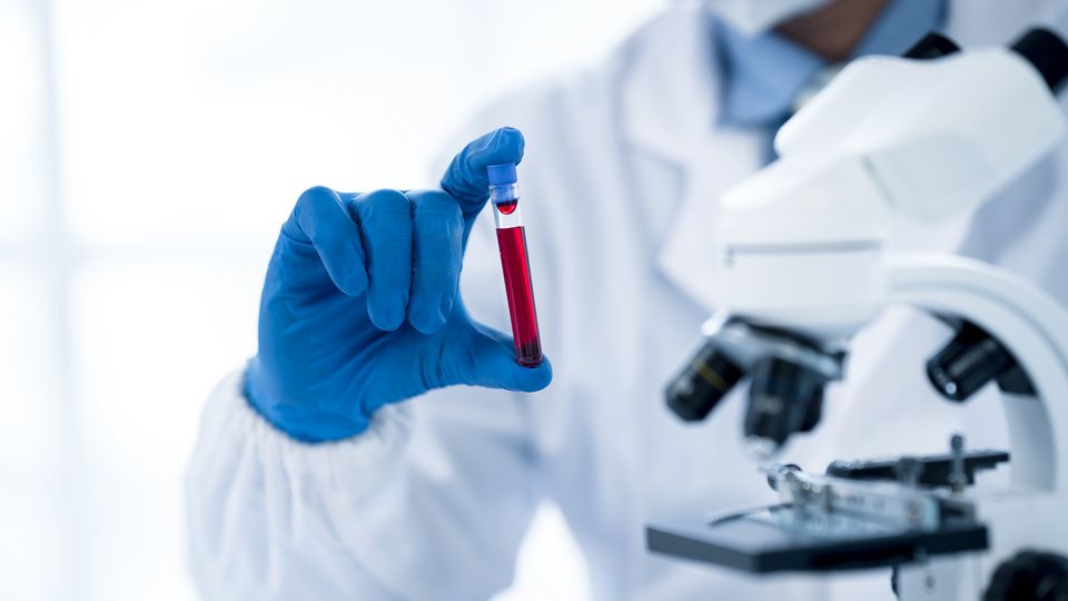 Scientist holding a test tube of blood next to a microscope.