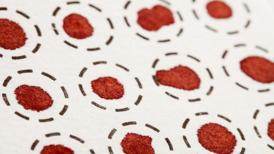 Blood spot card showing several dried blood spots inside dashed black circles. 