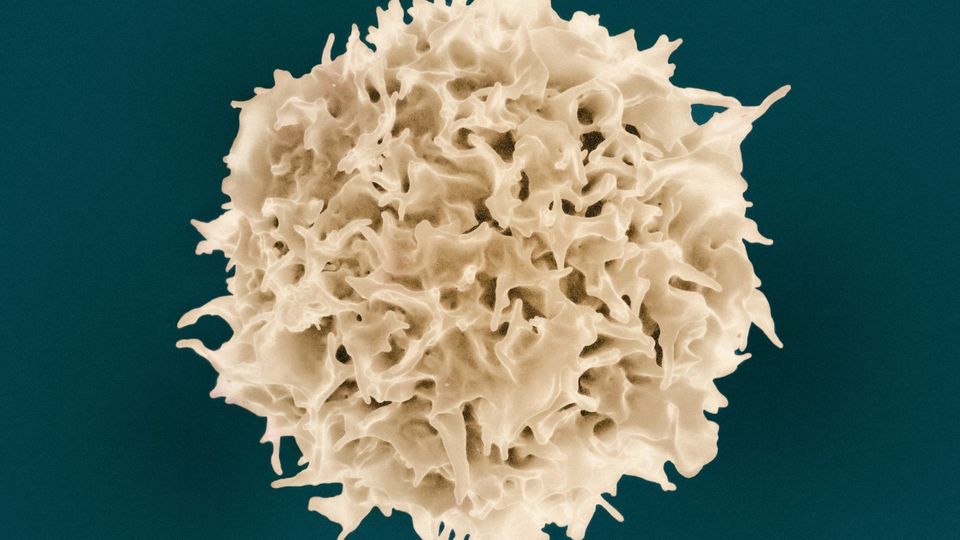 Scanning electron microscopy image showing a T lymphocyte.