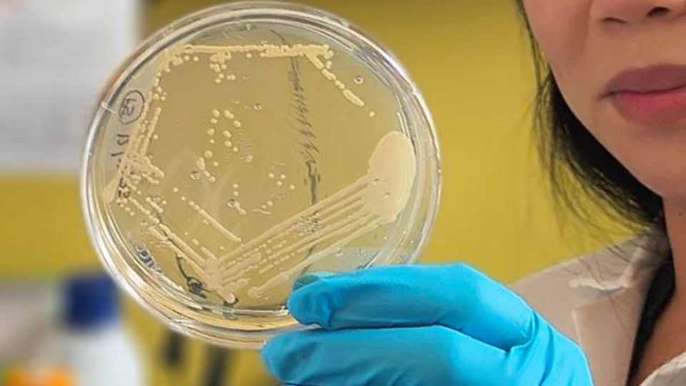 Auto-Brewery Syndrome May Be Diagnosed With New Stool Test | Technology ...