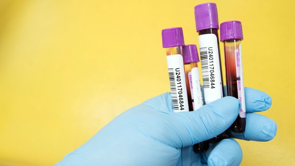 Gloved hand holding blood test tubes used for Crohn’s disease diagnosis.