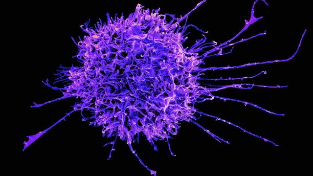 Microscopic visualization of CAR-T cell interacting with cancer cells during immunotherapy. 