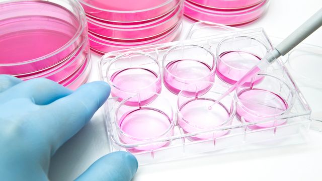 Lab technician handling cell culture plates with pink media for studying pathogenic C. auris fungi. 
