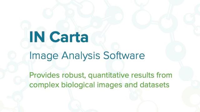 IN Carta image analysis software shown on a lab workstation, displaying quantitative cell imaging results beside a Molecular Devices instrument 