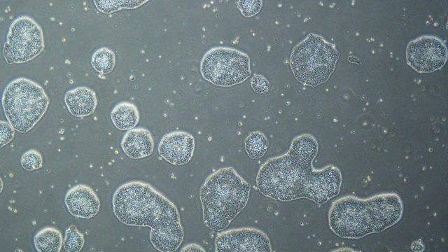 Microscopic view of hiPSC differentiation showing clustered stem cells in culture. 