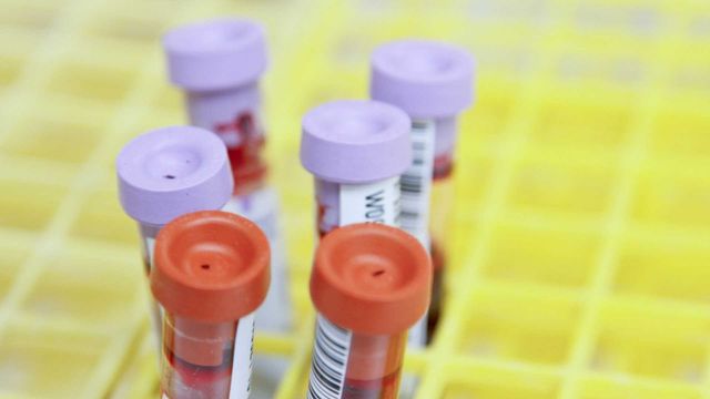 A Blood Test Could Spot Parkinson’s Years Before Symptoms