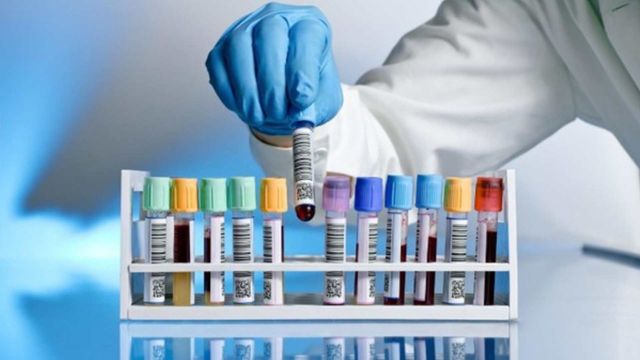 Technician handling barcoded blood sample tubes representing rapid sterility testing in a laboratory. 