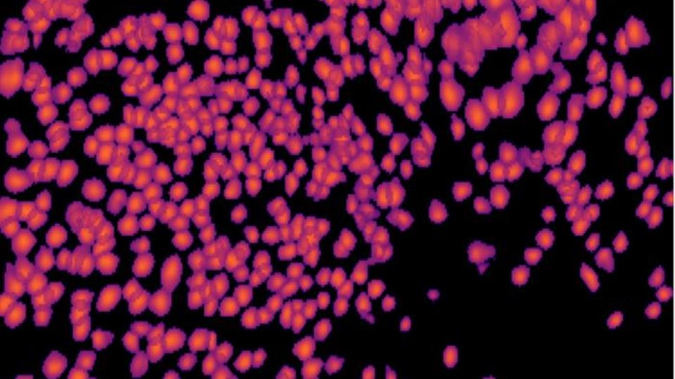 Fluorescent micrograph of hippocampus neurons, highlighting neural activity involved in learning and memory.