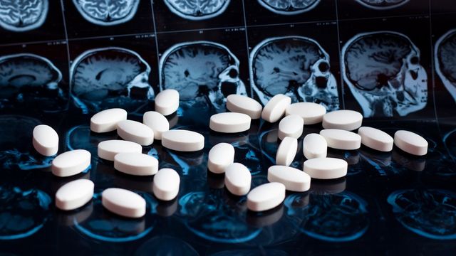White pills on top of MRI scans of the human brain, representing neurotherapeutics. 