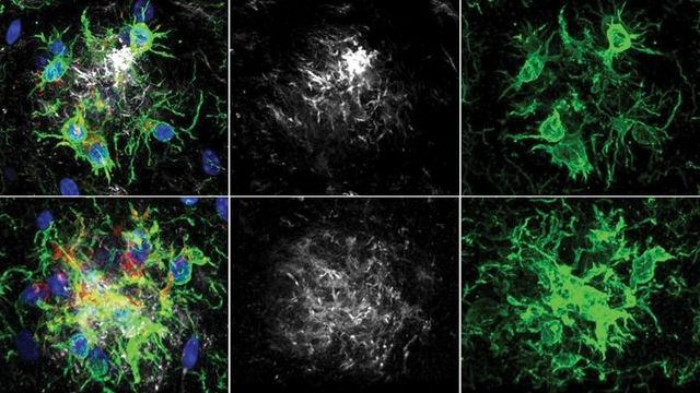 A two by three grid of images illustrate how inhibiting PTP1B improved microglial activity. 
