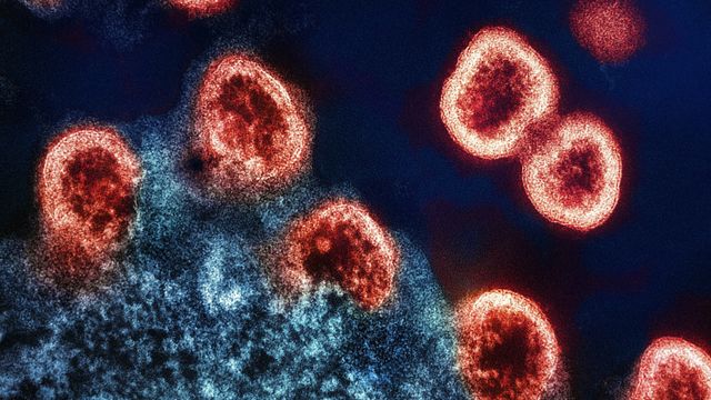 Electron micrograph image of HIV-1 particles colorized in red, replicating from an infected T cell colorized in blue. 