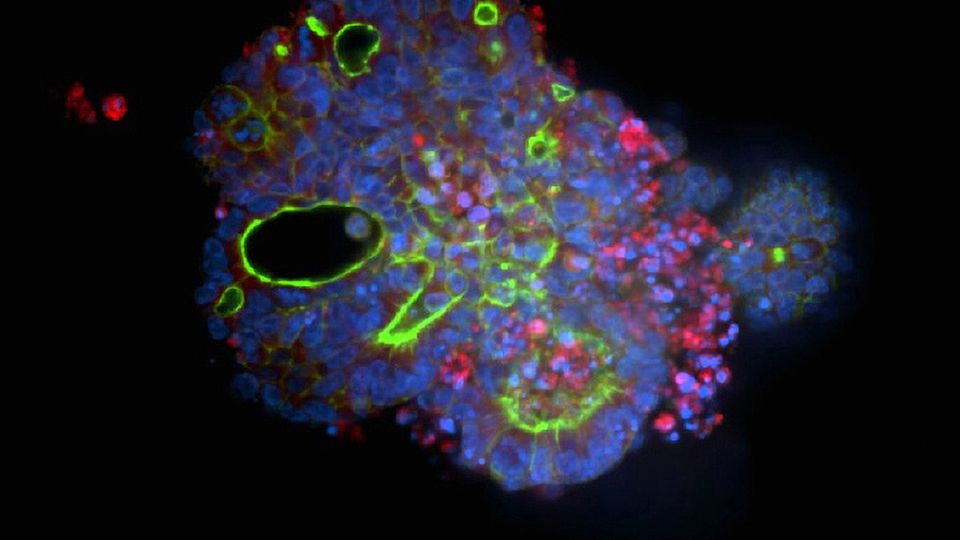 High-resolution image of CRC organoid sample, captured with the ImageXpress® HCS.ai Advanced High-Content Screening System.