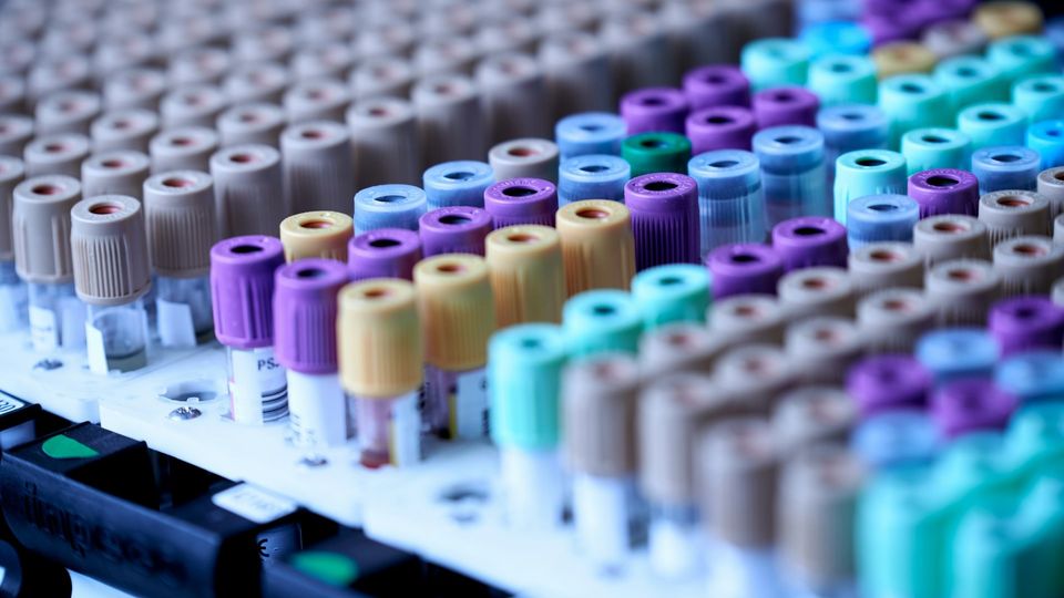 New DNA Extraction Kit To Boost Lab Consistency | Technology Networks