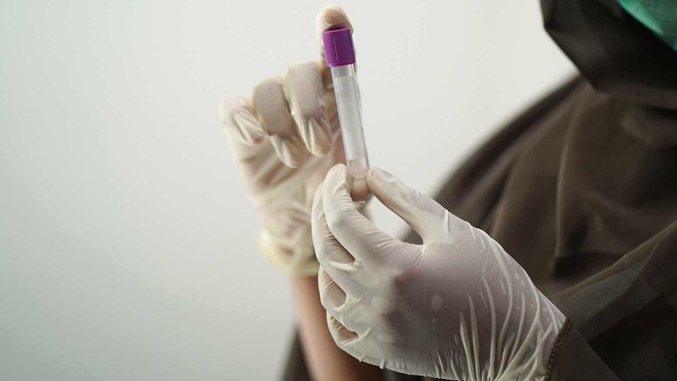 Gloved researcher holding a sample tube in lab, representing drug discovery research.