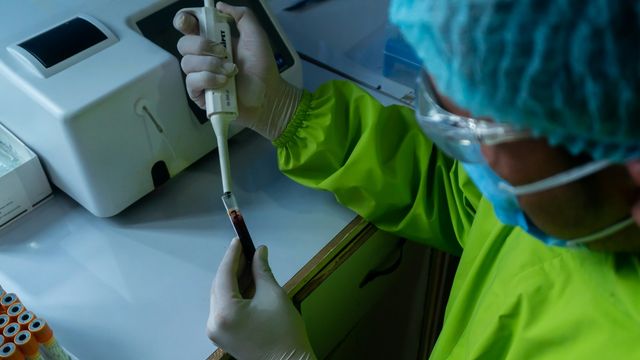 Researcher using pipette to analyze blood sample in lab for drug discovery. 