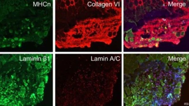 Image showing myoblast generation with MF20-positive myotube formation. 