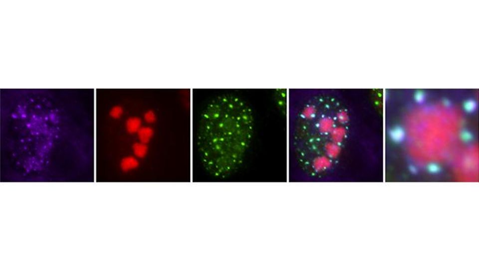 Fluorescence microscopy images of nuclear speckles in a cell nucleus.