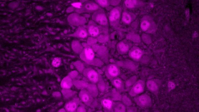 A new method lets researchers visualize messenger RNA translation across different brain cell types. In this image, CA3 pyramidal neurons of the mouse hippocampus glow magenta, indicating especially high rates of protein production. 