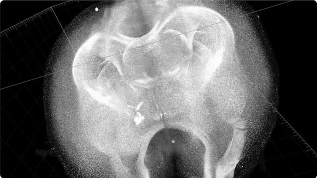 Researchers Map the Location of More Than 10 Million Cells in the Mouse Brain