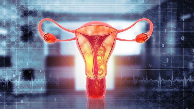 AI-Boosted Electronic Nose Detects Ovarian Cancer