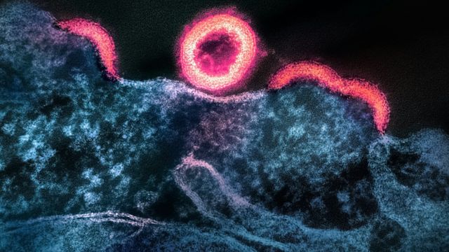 Researchers Grow HIV-Infected Reservoirs To Advance Cure Strategies