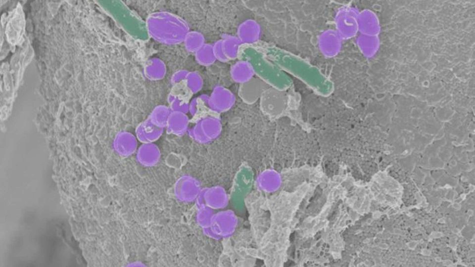 Rod shaped bacteria (green) surrounded by purple cocci in a gut microbiome SEM image.