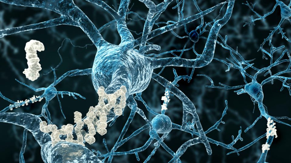 Proteomics and Brain Health: New Insights for Neurology | Technology ...