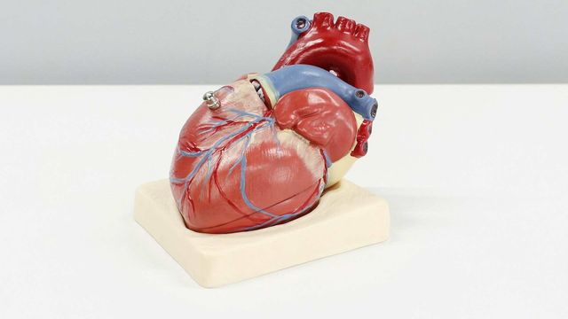 AI Predicts Risk of Serious Heart Disease From Mammogram Images