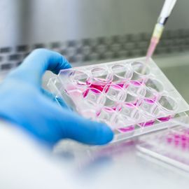 Gloved hand pipetting pink liquid into a multiwell cell culture plate in a laboratory setting. 