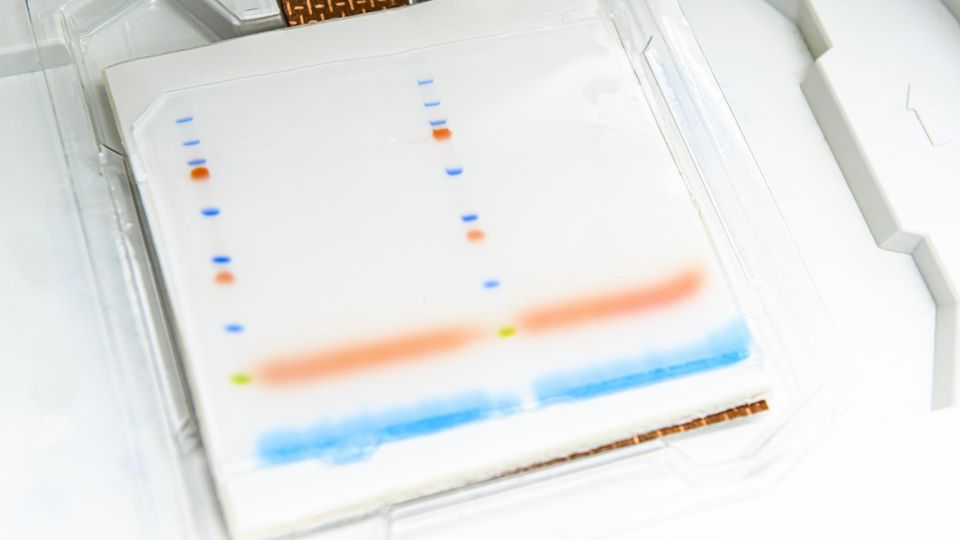 Gel electrophoresis plate showing separated protein or dye bands in multiple lanes, with blue and orange markers migrating across a white gel surface.
