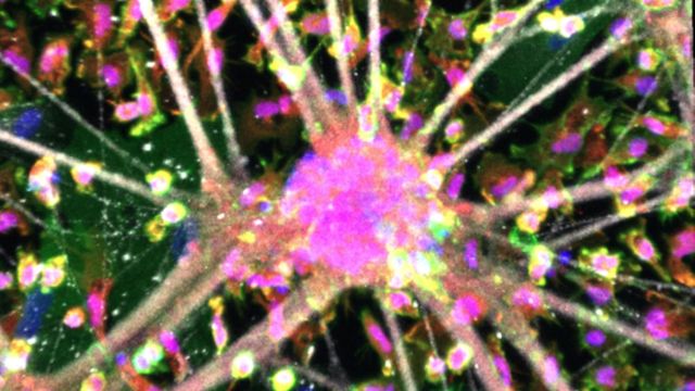 Fluorescent microscopy image of motor neurons, microglia, and astrocytes in triculture. 