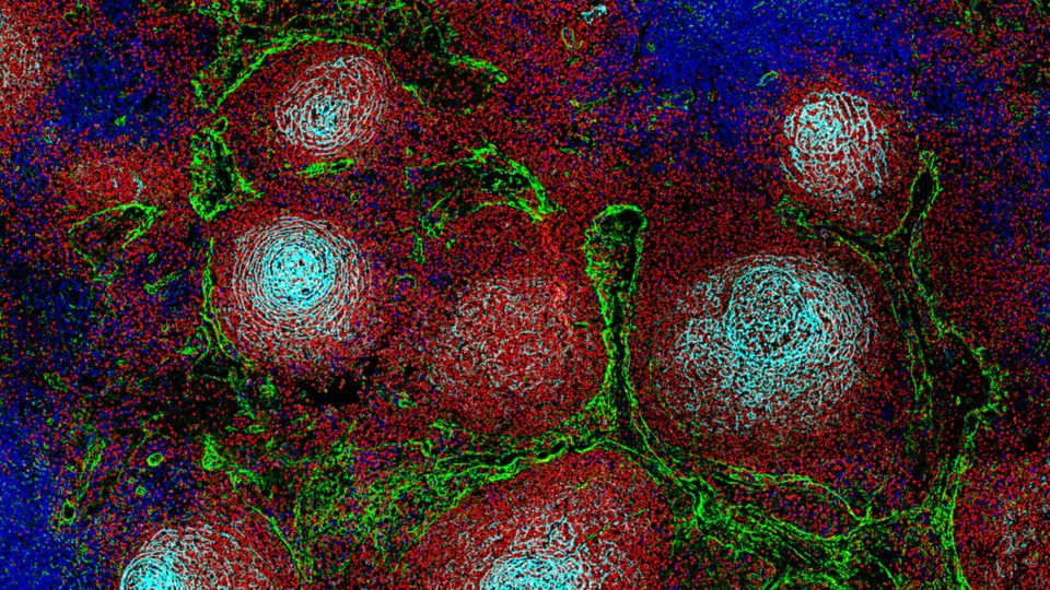 Lymphoma Disrupt Immune System Structure | Technology Networks