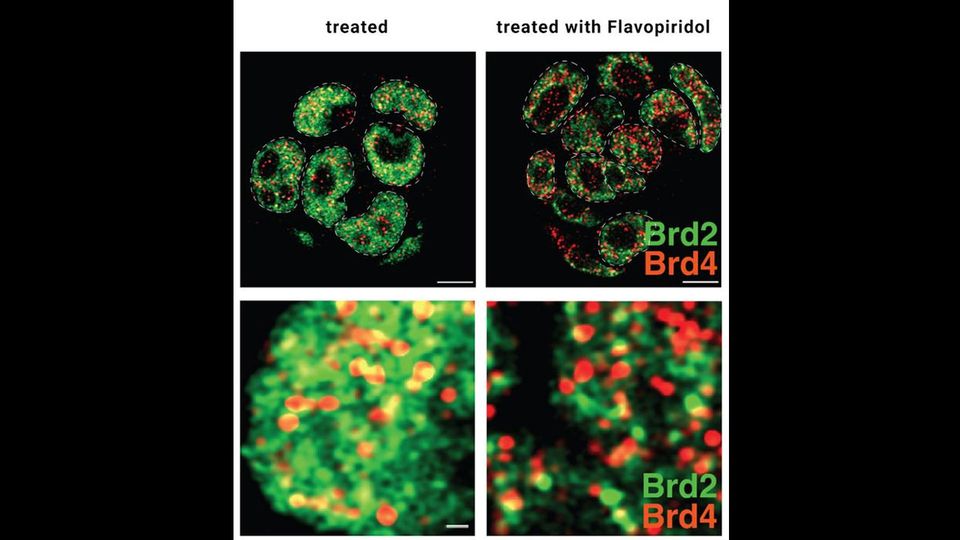 Four microscopy images, showing how Brd2 (green) and Brd4 (rede) have different roles.