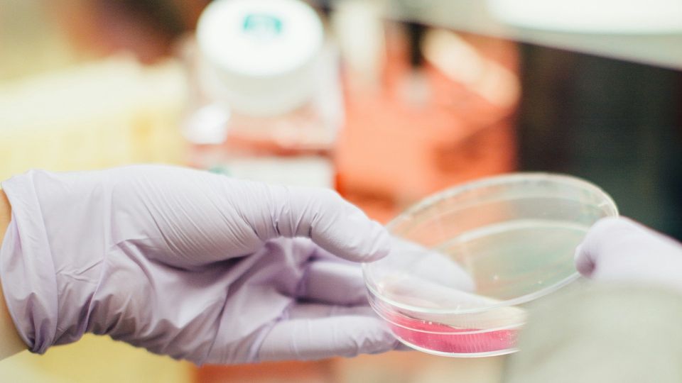 A gloved hand holding a petri dish with a growth medium.