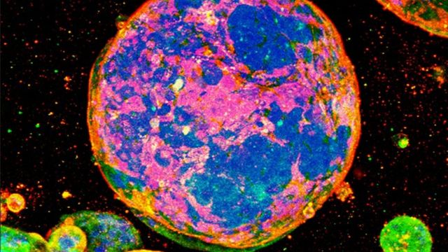 Fluorescent microscopy image of multicellular spheroids with vivid staining. 