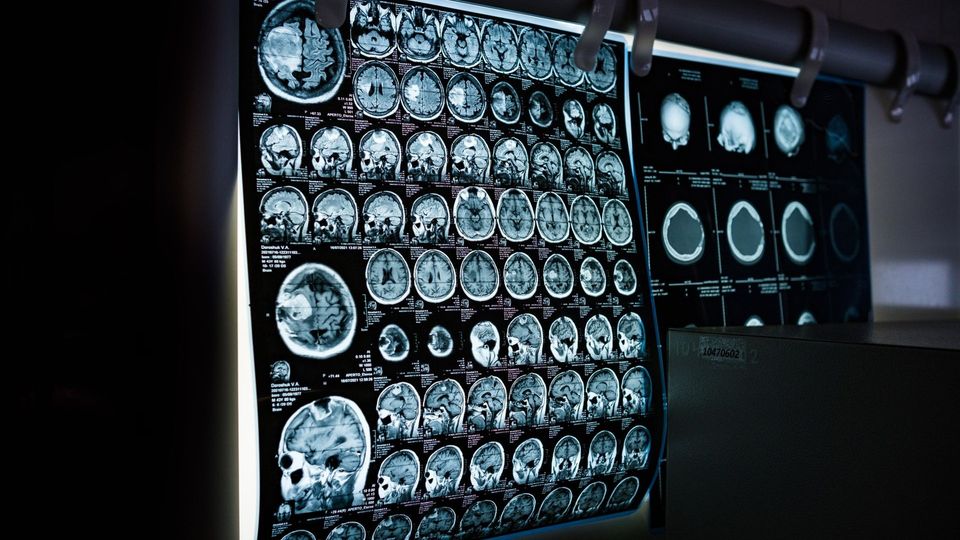 Brain MRI scan panels displaying multiple cross-sectional images