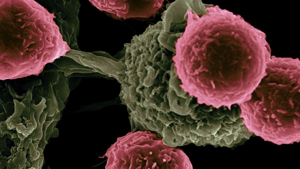 Electron microscope image of dendritic cells, pseudo-colored in green, interacting with T cells, pseudo-colored in pink.