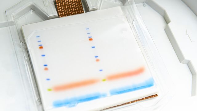 A western blot gel with tracking dye showing the positions of various proteins in blue and orange. 