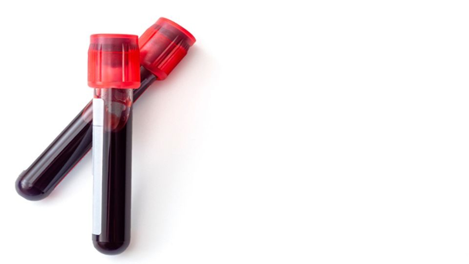 Two tubes of blood samples laying on a white background.