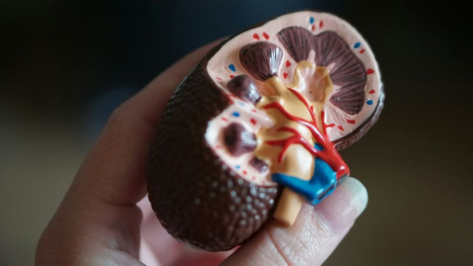 Kidney model cross-section in hand showing internal anatomy and vessels.